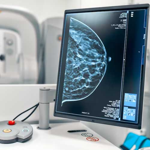 Mammografi - RSIA Bina Medika